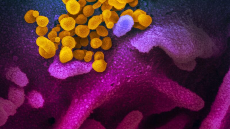 Covid-19: estudo aponta aumento de bactérias resistentes em UTIs